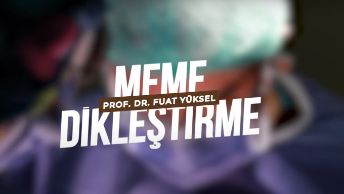 Meme Dikleştirme