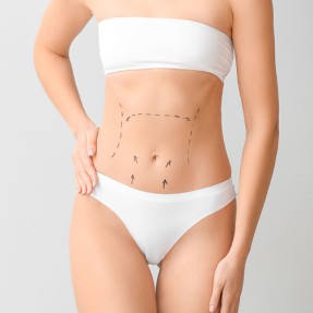Liposuction
